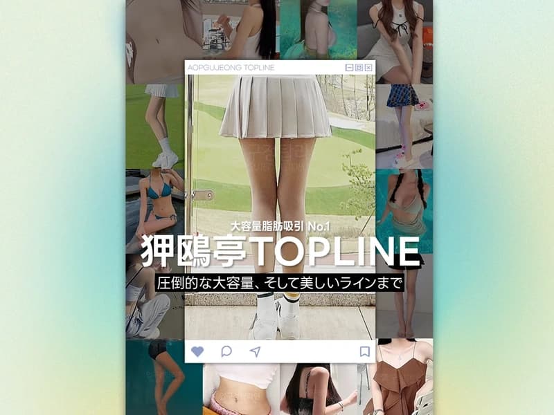 일본 시장 타겟 성형외과 이벤트 페이지 — 수정, 유지보수, SEO 미리보기